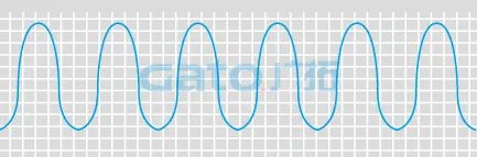 干貨|太全了，振動光纖7大場景的安裝方式圖文詳解！(圖21)